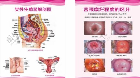 宫颈图女性解剖图图片