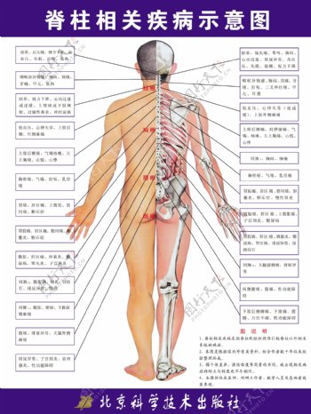 脊椎相关疾病图片