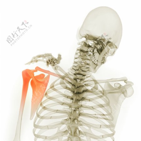 肩部X光图像图片