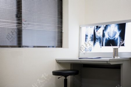 医院办公室里的X光片图片