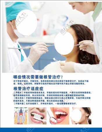 牙科根管治疗图片