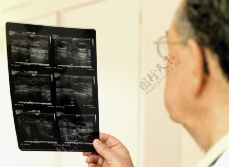 看x光片子的医生图片