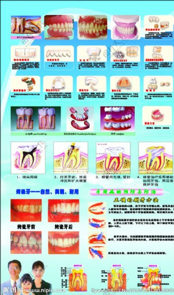牙科的种类图片