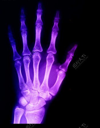 X光手骨医疗科技卫生图片