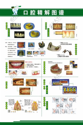 口腔图谱图片