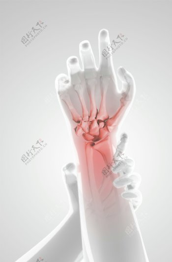 手腕X光图像图片