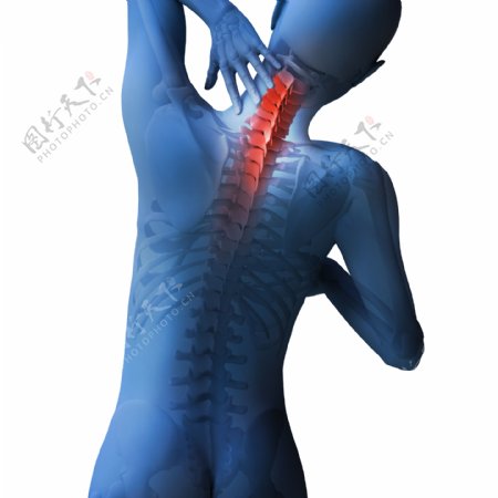 颈椎关节疼痛图片