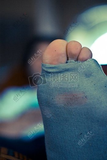 破烂的蓝色丝袜