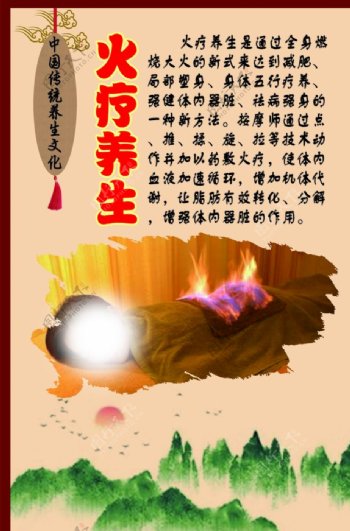 中华传统养生文化之火疗养生